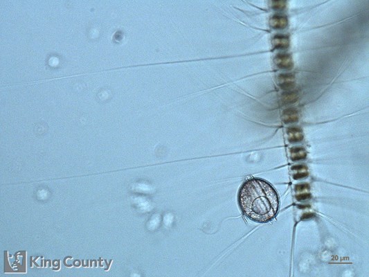 Photo of Diplopsalid dinoflagellates